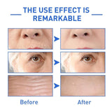 Botox Anti-Aging Serum(Pack of 2)